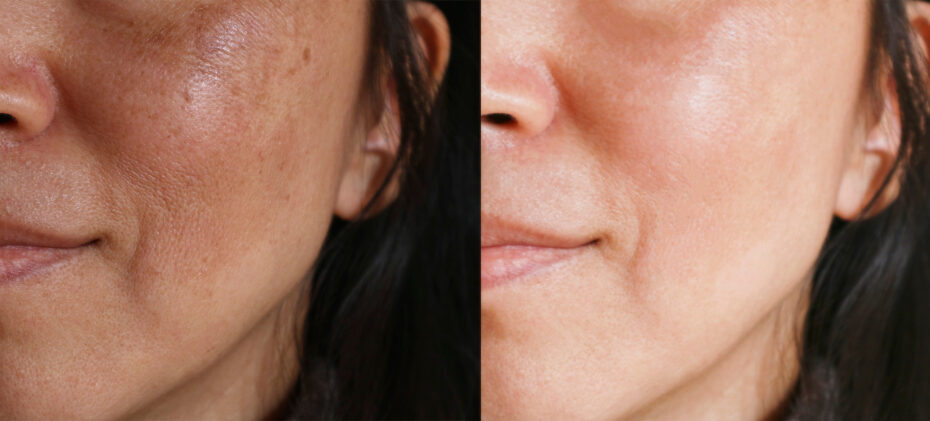 Long-lasting Cheek Blush Tattoo