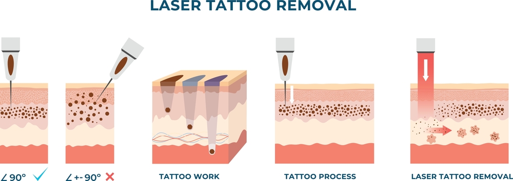 Where to Get the Best Permanent Makeup Services