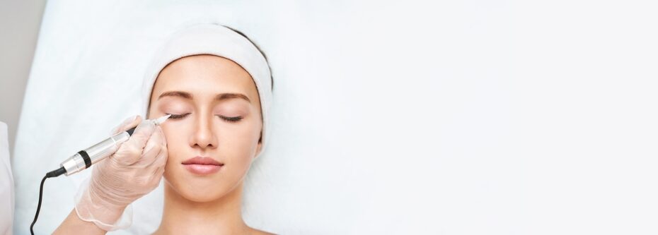 Skin Peel for Oily Skin