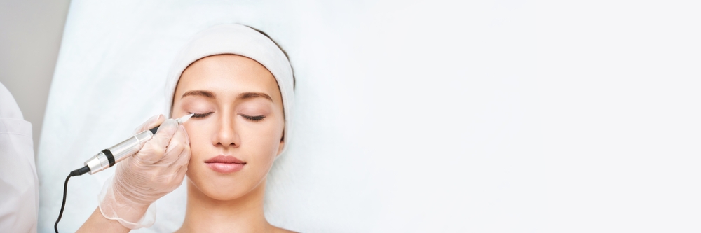 Skin Peel for Oily Skin