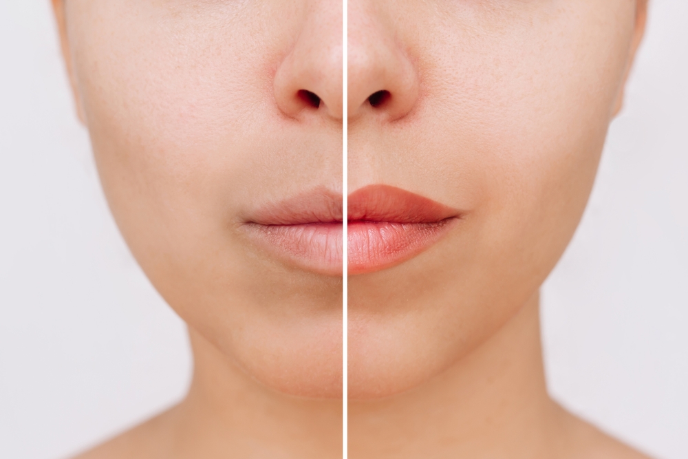 Best Lip Blush in Bangalore