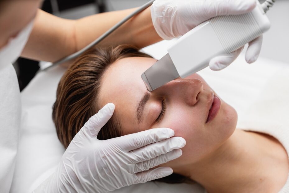 Best Place for Skin Peel Treatment in Bangalore