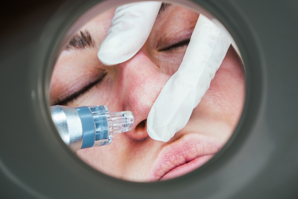 Oxygen Facial Before and After 2026