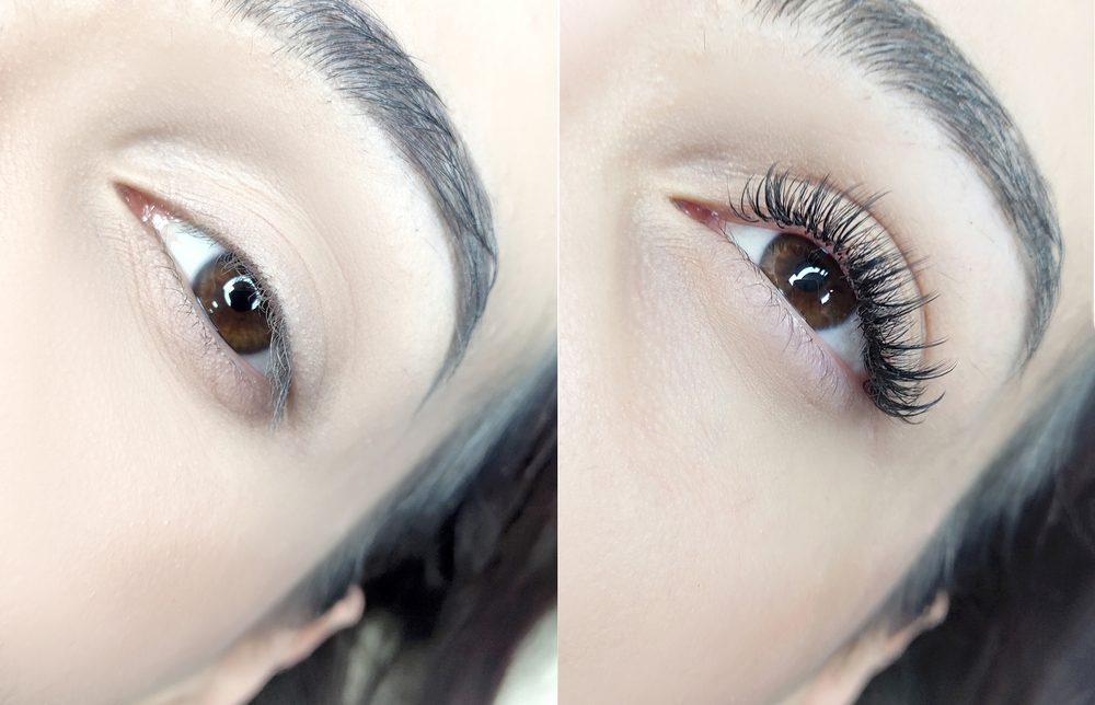 Eyelash Extensions Treatment Cost in Bangalore