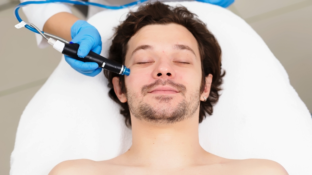 HydraFacial for Men