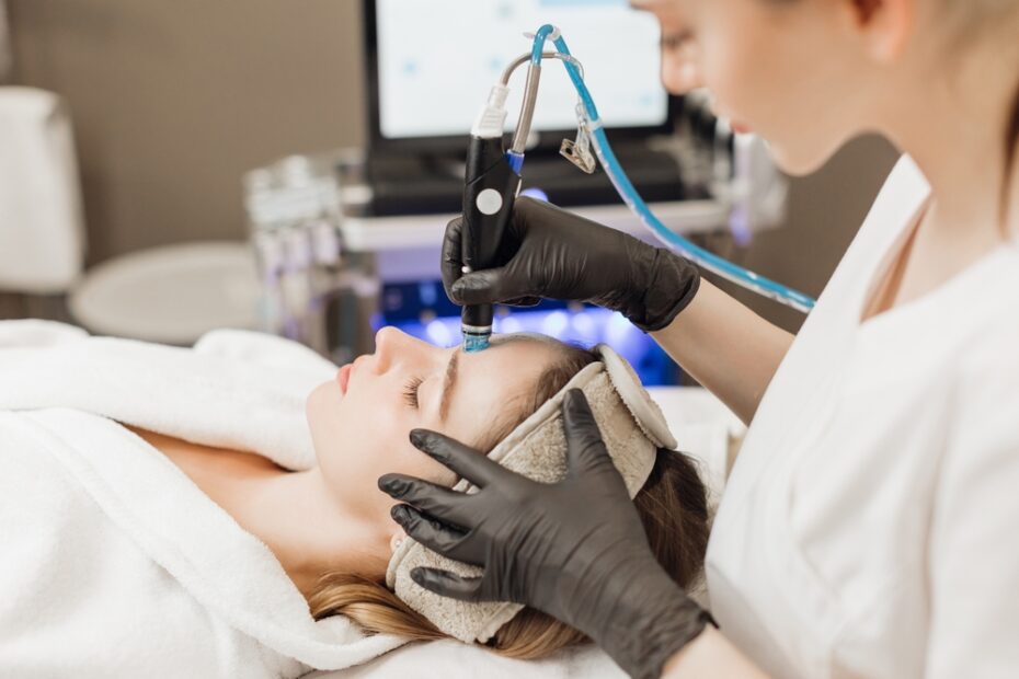 Dark Spot Removal Peel