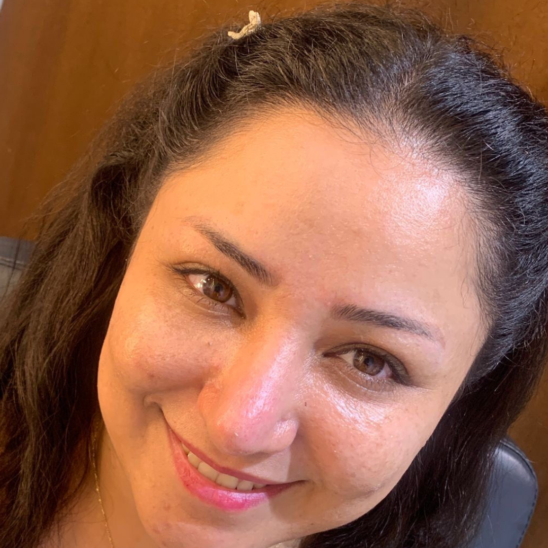 Anti Aging Hydra Facial