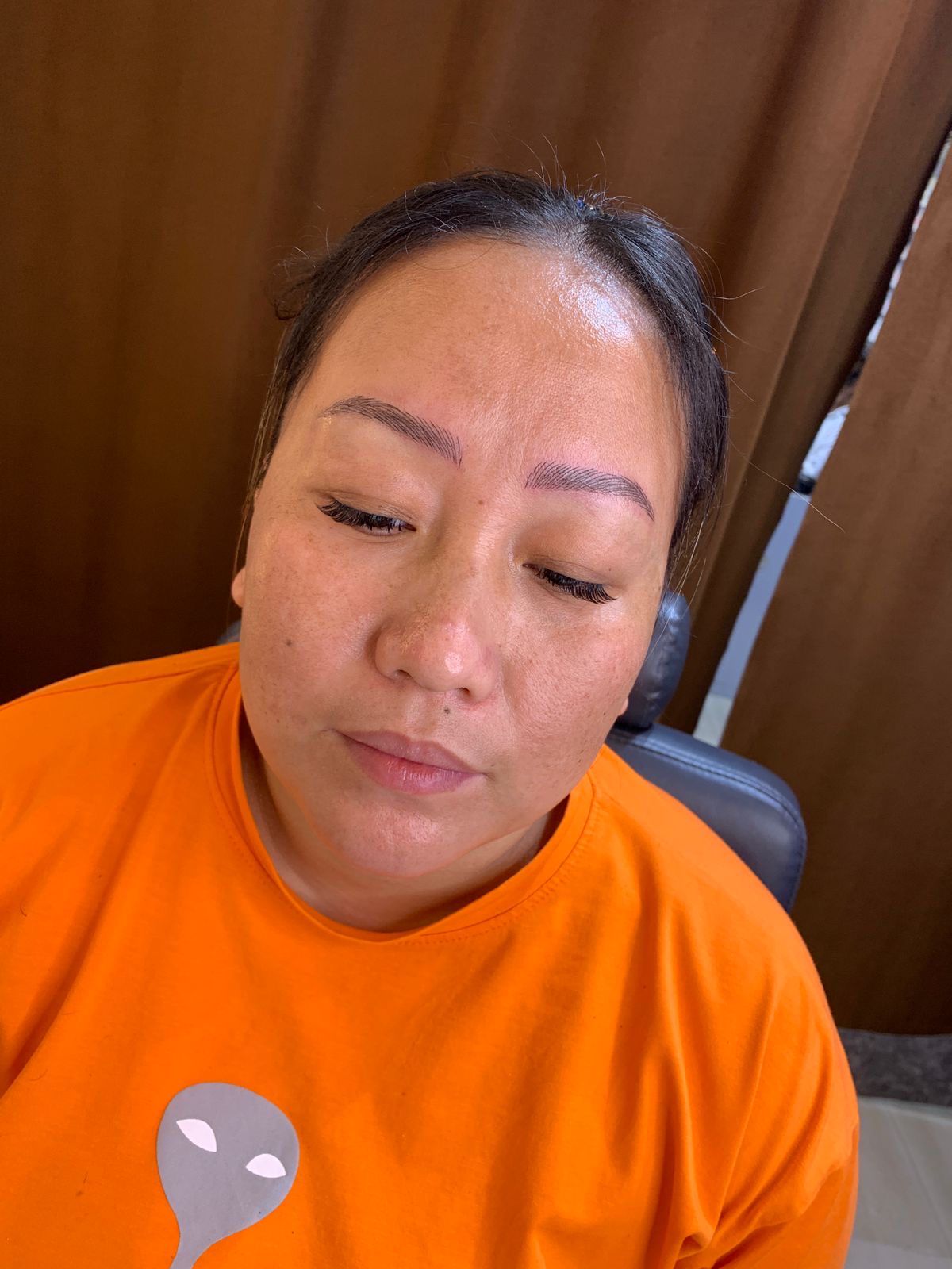 B B Glow Microneedling Facial