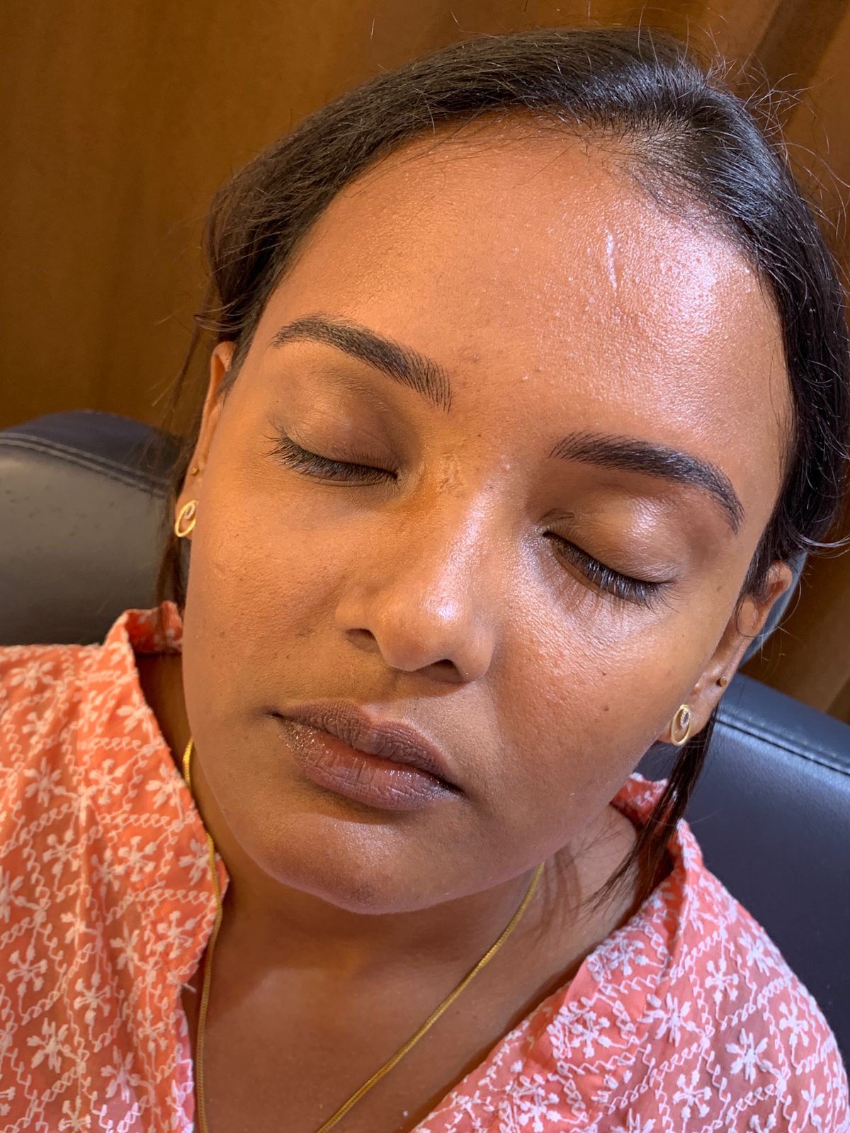 Summer Skin Brightening Treatment