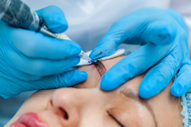 Aftercare for Microblading Removal