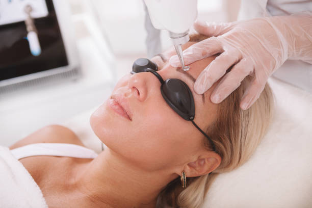 Microblading Removal Cost in 2026