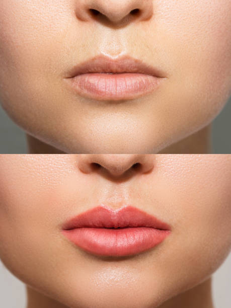 Summer Lip Blush