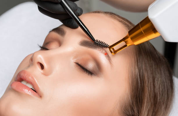 Microblading Removal in Delhi 2026