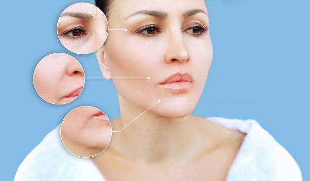 Fine Lines and Wrinkles Treatment 2026