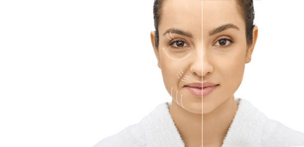 Fine Lines and Wrinkles Treatment 2026